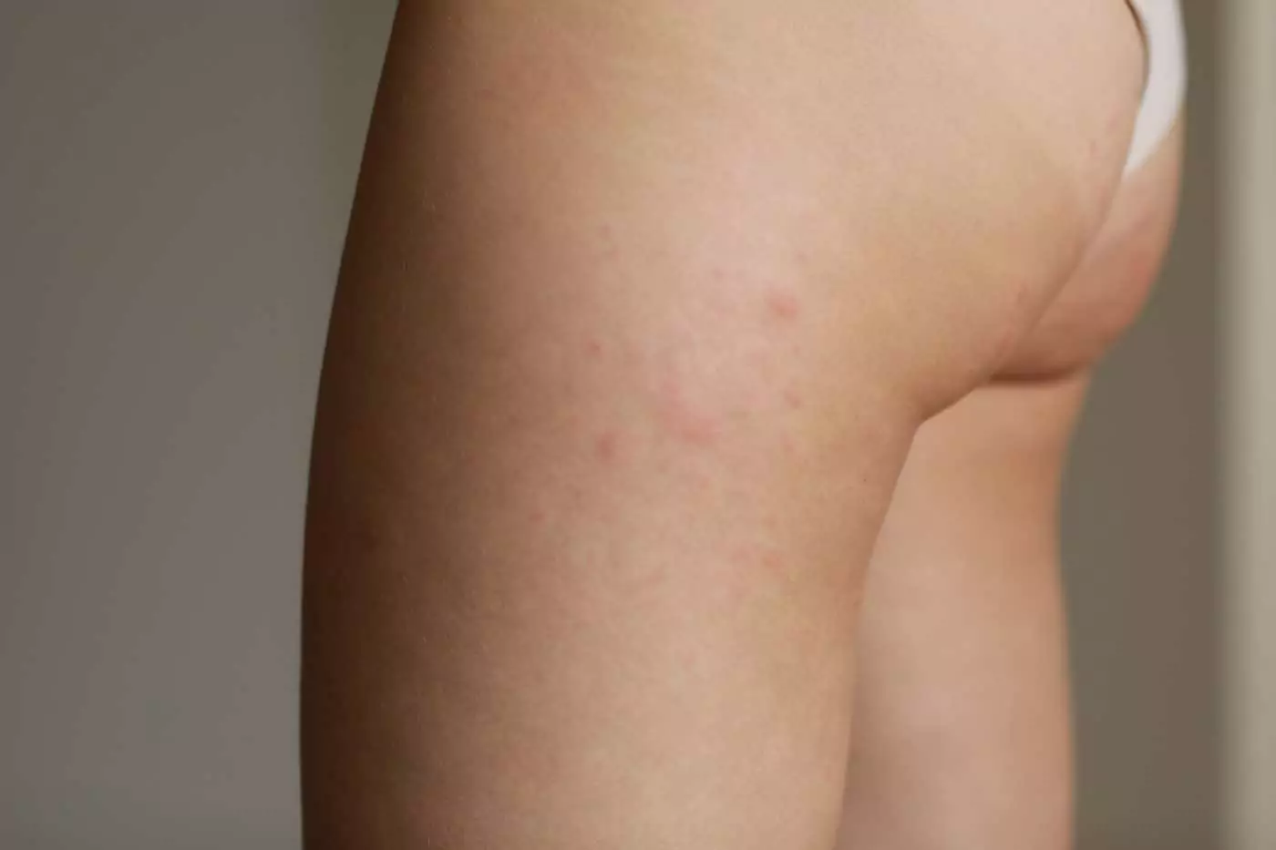 Impara a convivere con l'allergia al pelo di cane: scopri le cause, conosci e sintomi e apprendi i rimedi per prevenire la reazione allergica per una convivenza felice.